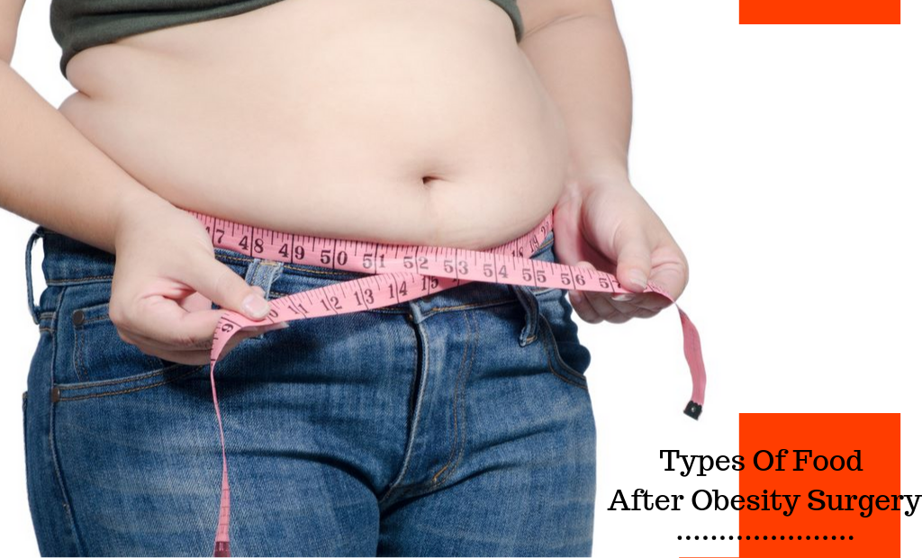 Types Of Food After Obesity Surgery